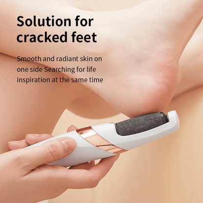 SmoothStep rechargeable foot file in white and pink colors with ergonomic design for callus removal