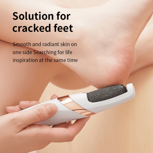 SmoothStep rechargeable foot file in white and pink colors with ergonomic design for callus removal